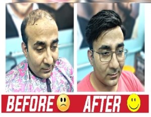 Hair Weaving and Hair Fixing in Delhi